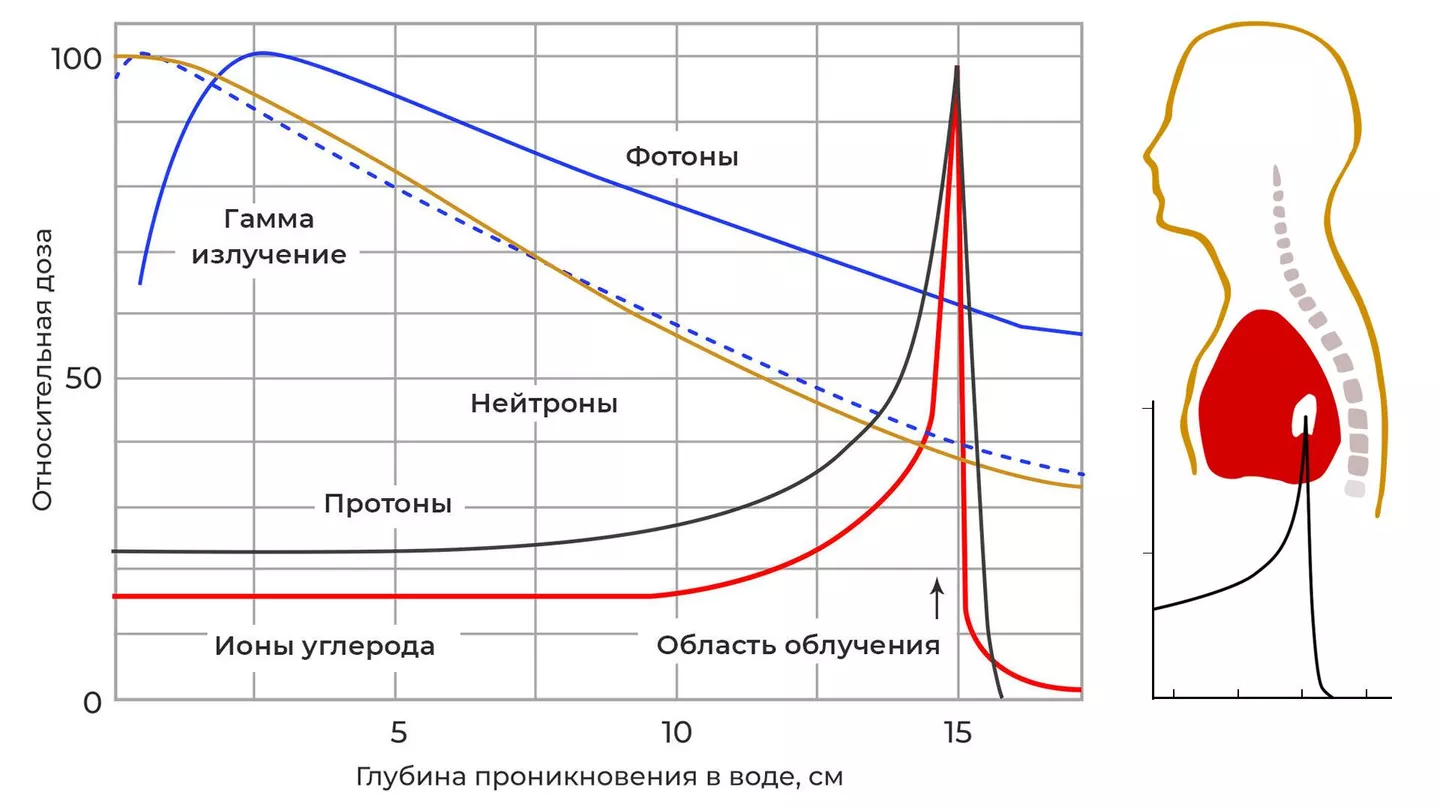 Ученые нашли способ излечения от рака за несколько секунд