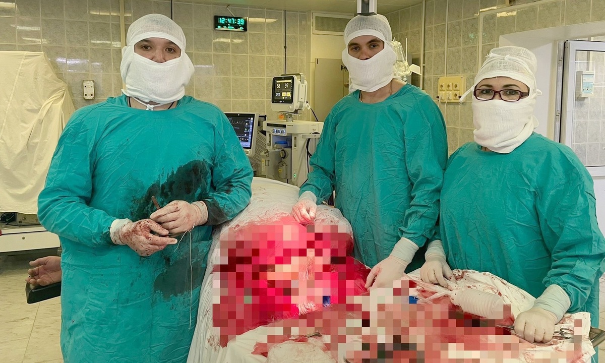 У 220-килограммового мужчины удалили огромную опухоль, которую он не замечал