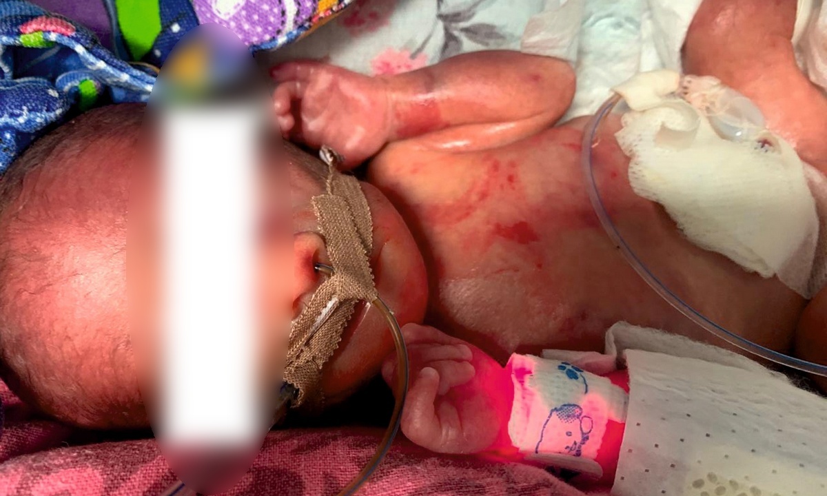 В Карелии не смогли спасти новорожденного малыша
