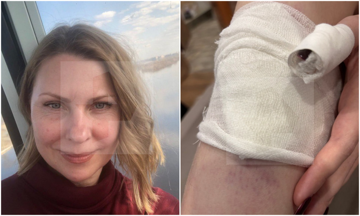 «Огромные гематомы». Стало известно, кто пострадал на опрокинутой лодке в Карелии