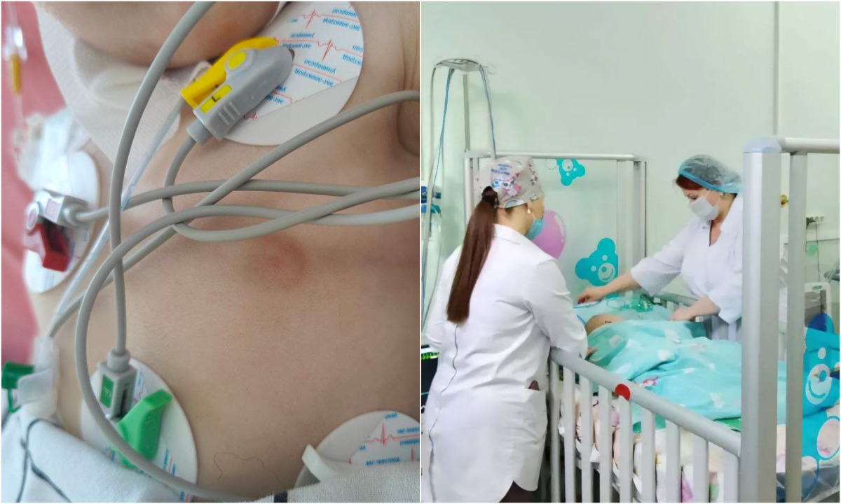 «Цена беспечности»: собака разорвала лицо малышу, который остался без присмотра