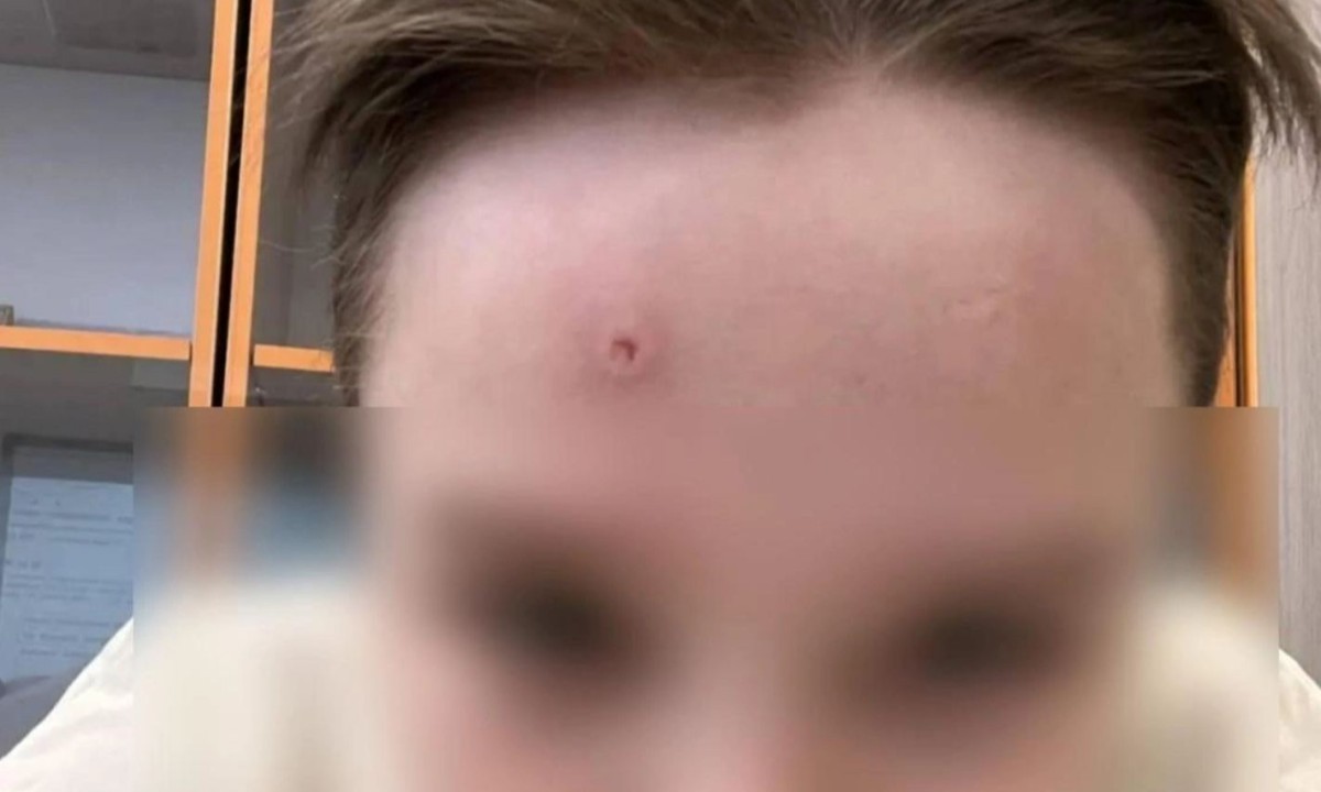 «Угрожал и запугивал»: школьник выстрелил однокласснику в лоб во время контрольной