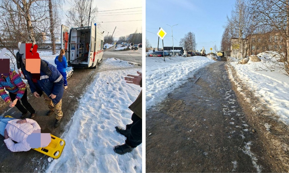 В Петрозаводске беременная упала на скользкой дороге