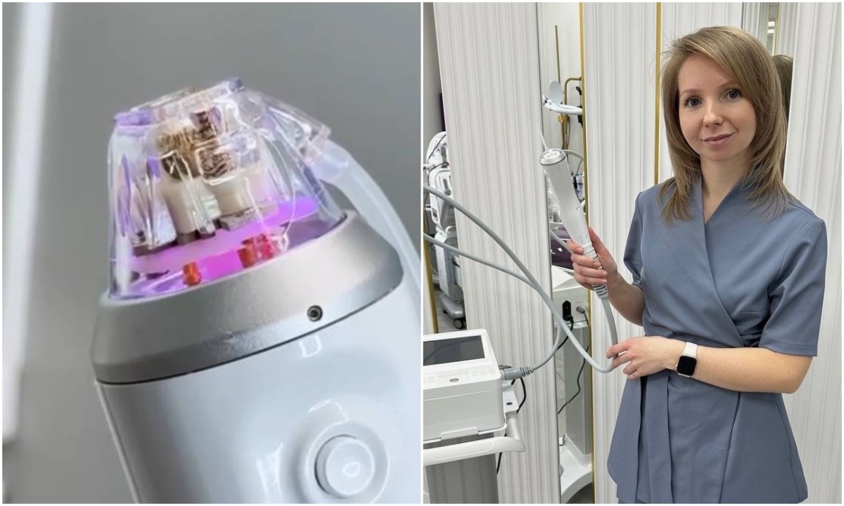 RF-лифтинг: как вернуть коже тонус без боли, уколов и долгой реабилитации