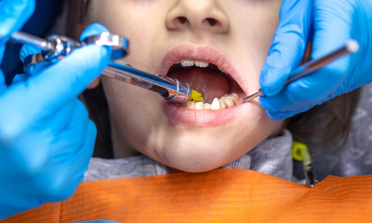 «Я и рыдала, и молилась»: игла провалилась в желудок 9-летней девочки из Петрозаводска во время лечения зуба