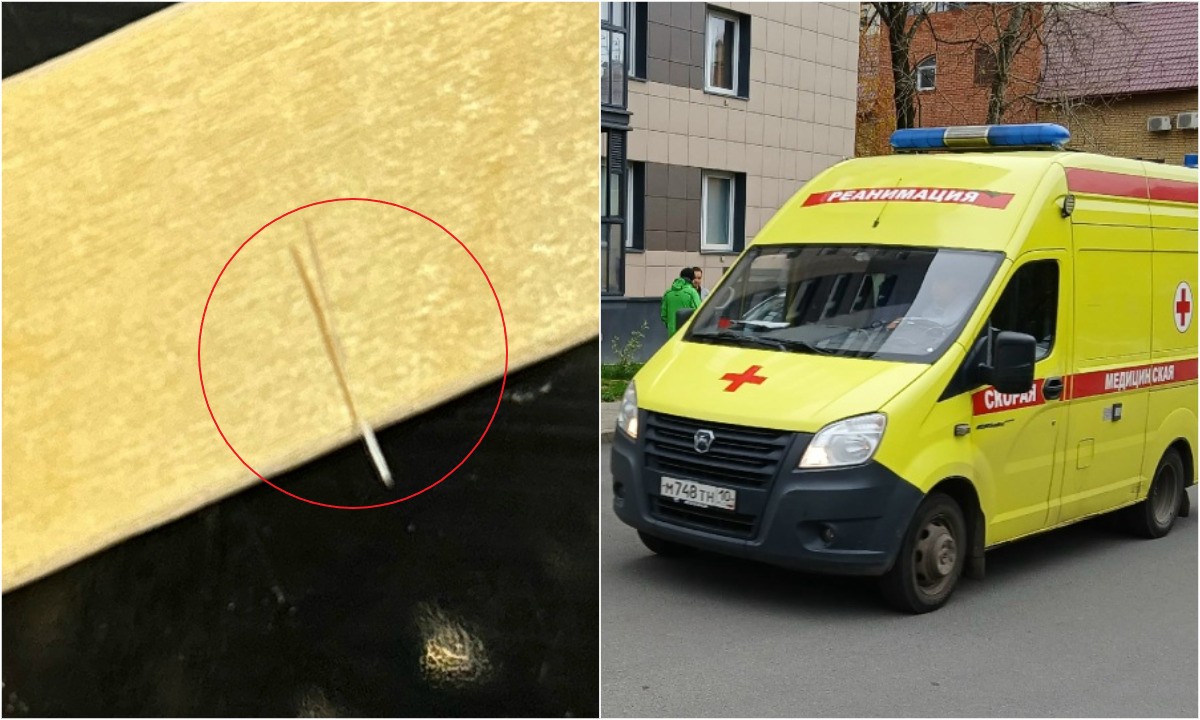 «Невыносимая боль»: в Карелии беременная мать чуть не умерла, проглотив рыбную кость в роллах