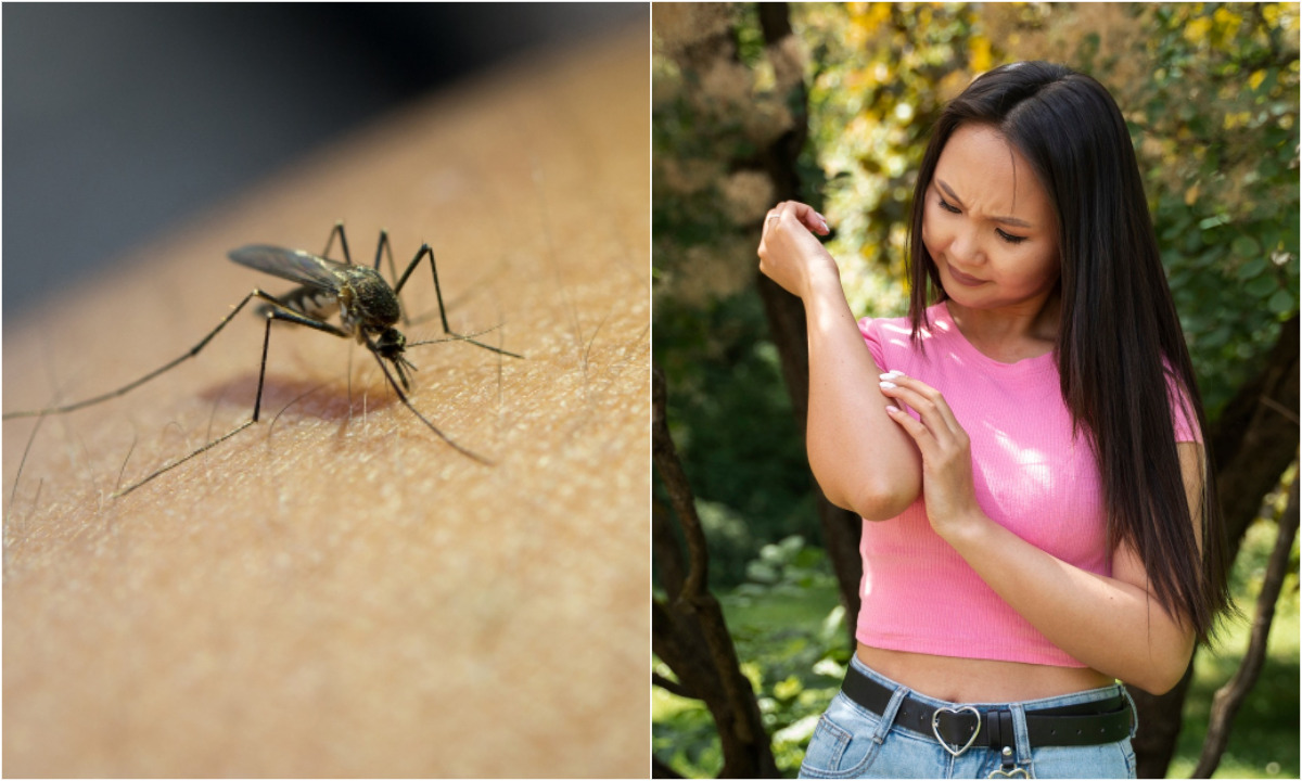 Выяснено, людей в какой одежде чаще всего кусают комары