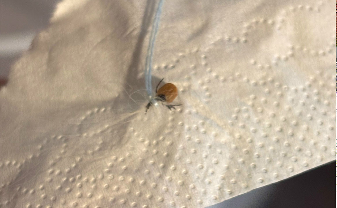 Названы признаки заражения после укуса клеща