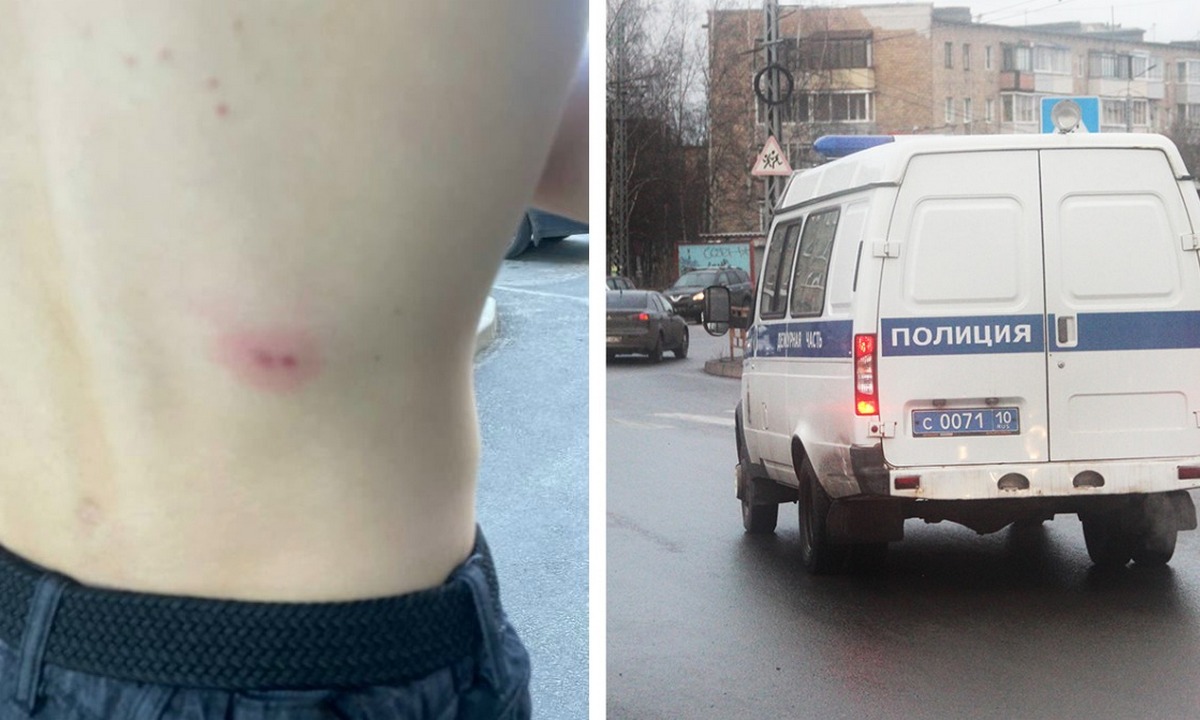 В ребенка выстрелили из пневматики в Петрозаводске