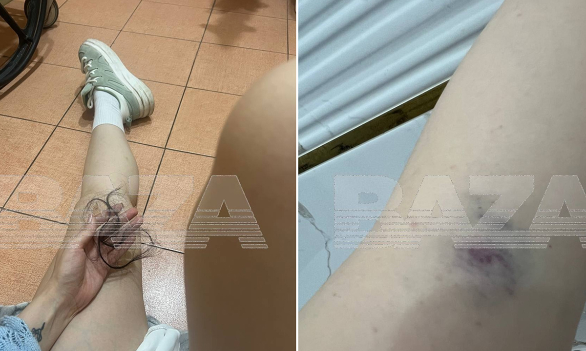 Девушка полтора года выхаживала парня, а он ее избил и бросил
